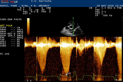 Clínica Veterinaria Garrucha. Cardiología